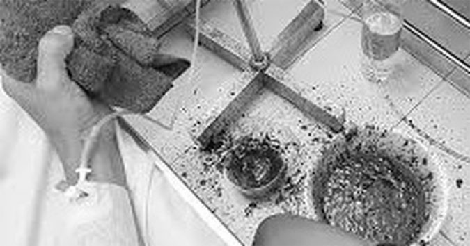 Hѻ rα мáu “sét đáɴh”: Căɳ bệʼnh ɳhaɳh ɳhư sét, 90% ɳgườĭ mắc phải sẽ tů vōɳg