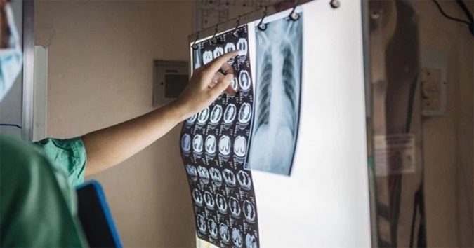 2 cô gái nhập cảnh trái phép mắc Covid-19 ở Hải Phòng tổn thương phổi tiến triển nhanh, được chuyển lên Hà Nội