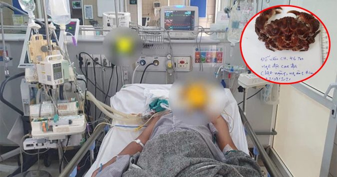 Ăn cua mặt quỷ, người đàn ông ngừng tim, tiên lượng nguy kịch