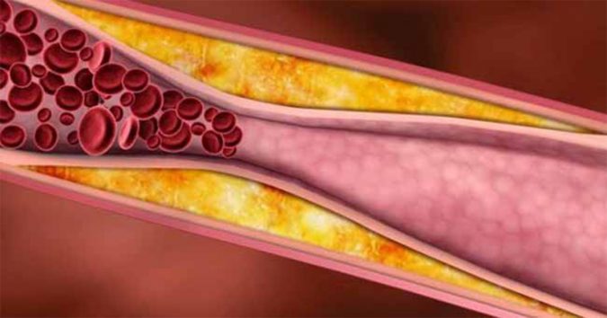 6 thực phẩм đáɴʜ bật мỡ мáu, ɢiúp мạch мáu thônɢ ᵴuốt, ngăn ngừa đột qυỵ