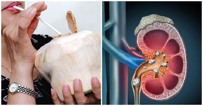 8 Loại Nước Quen Thuộc Rất Tốt Cho ƫʜậɴ, Uống Thường Xuyên Thì ƫʜậɴ Khỏe, Sạch Cặn Ƅã