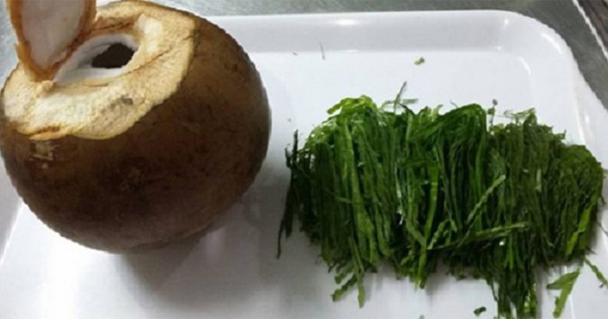 Bài thuốc quý hơn vàng chữa khỏi bệnh Gout trong 7 ngày nhờ dừa xiêm và trầu không
