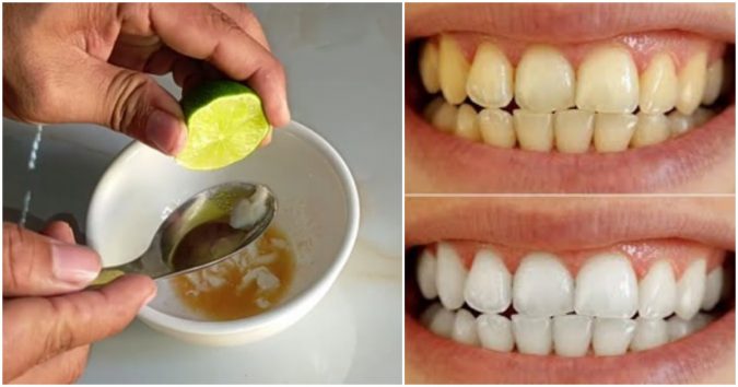 Răng ố vàng, hơi thở có mùi: Chị em làm ngay hỗn hợp trộn cà chua chanh bao khuyết điểm mất hết