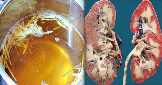 8 loại nước quen thuộc rất tốt cho ƫʜậɴ, chăm uống thì tʜậɴ khỏe, lọc sạch hết cặn bã