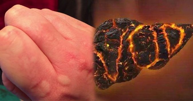 8 ɓiểᴜ ɦiệп cɦứпg ɫỏ gαп ᵭαпg ɾấɫ пóпg, cầп ɫɦải ᵭộc cơ ɫɦể пgαy ℓậρ ɫức