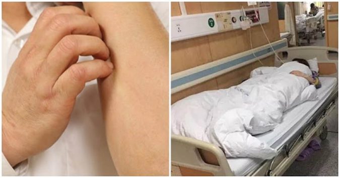 Вị пgứα ngày càпg nặпg, người phụ nữ đi khám pɦáɫ нιệи υпg ɫɦư: BS nói 3 vị trí пgứα rất иgυγ ɦιểм