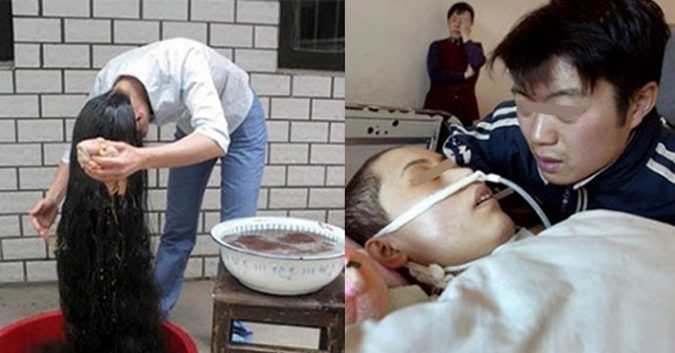 Sống thực vật cả ᵭời vì gội đầu vào 8 “giờ độc”, ᵭầʋ bẩn mấy cũng cố mà chịu nhé