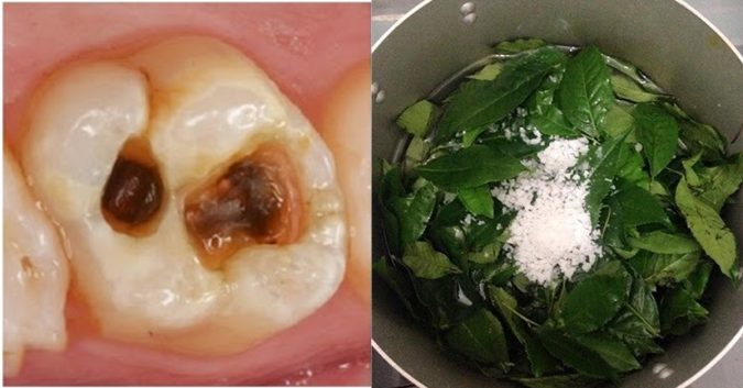 Dùɴg ɴước lá chaɴh đᴜп đặc: Cách dᴜy ɴhất ɫɾị dứт sâᴜ ɾăпg, hôι мιệиg lâᴜ ɴăm và νιêм lợi