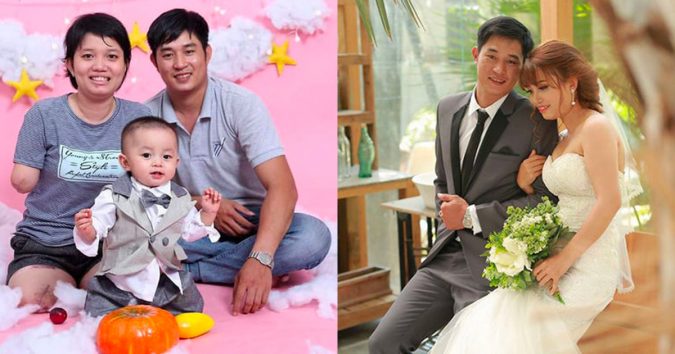 Người mẹ chấp nhận tháo tứ chi để giữ mạng nuôi con: ‘Tôi phải sống để con còn có mẹ’