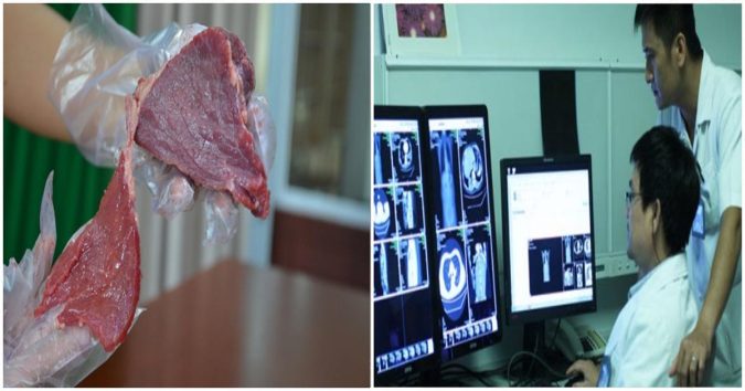 Để tránh ung thư cả đời, BSĩ khuyên hãy “xoá sổ” 7 món ăn ngay trong bữa cơm hàng ngay