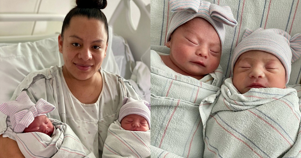 Cặp sin͙h đôi chào đời cách n͙hau 15 phút n͙hưn͙g hơn͙ kém n͙hau 1 tuổi, xác suất xảy ra n͙hư vậy chỉ 1/2.000.000 ca sin͙h trên͙ thế giới