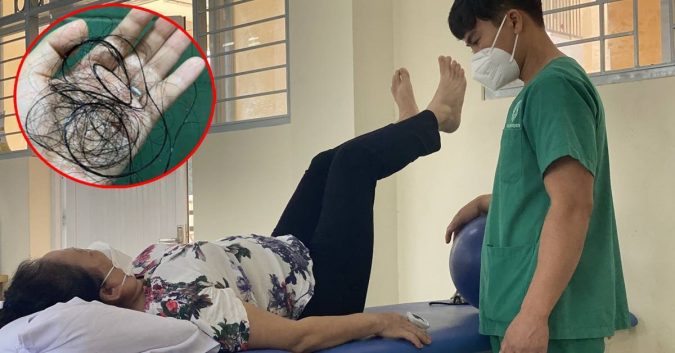 Hậu Covid, hoảng hốt tóc rụng cả nắm, “dâu rớt” rối loạn: Có thể kéo dài, BS chỉ cách chữa