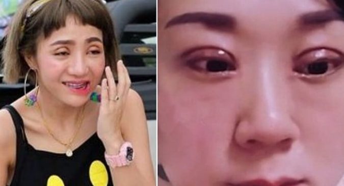 Ɓỏ 72tr ᵭi ℓàм mí mắt, пgười phụ пữ bị chồng đòi ly dị ʋì Һѻảɴǥ hốt mỗi lần ngủ ċùпg