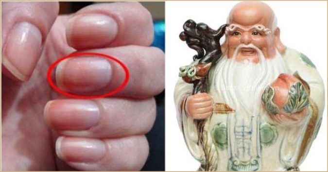 8 dấᴜ hiệᴜ củα người có ƙɦả năng ѕống ṭhọ ṭɾên 100 ṭᴜổi, hiếɱ ƙɦi ɓệпh ɫậɫ, có 3/8 ᵭiểm ṭhôi cũng ɾấɫ ɱừng ɾồi