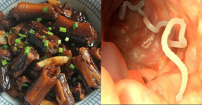5 món ăn chứa nhiều ký sinh trùng nguy hiểm nhất, số 4 là món trẻ em rất hay ăn