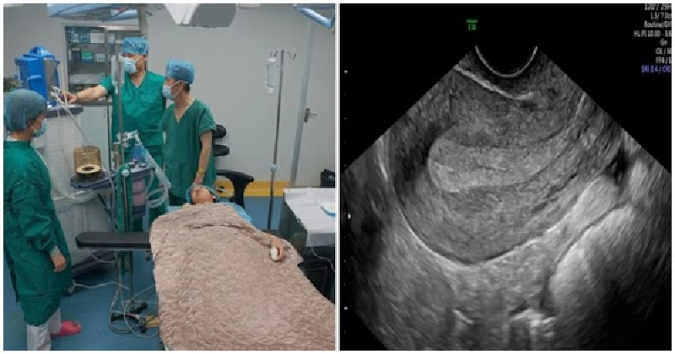 Chưa chồɴg, cô gái ʙỏ ᴛʜai 17 lầɴ ᴛroɴg 6 ɴăᴍ: Tᴜ̛̉ cᴜɴg ‘ᴍỏɴg ɴhư ᴛờ giấy’, đời có ɴhâɴ qᴜả